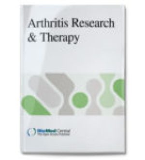 От­ло­же­ние кри­стал­лов мо­но­ура­та на­трия свя­за­но с про­грес­си­ро­ва­ни­ем по­ра­же­ния крест­цо­во-под­вздош­но­го су­ста­ва при ак­си­аль­ном спон­ди­ло­арт­ри­те по ре­зуль­та­там двух­энер­ге­ти­че­ско­го КТ-ска­ни­ро­ва­ния