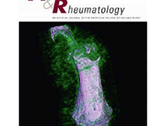 Влияние Омега-3 полиненасыщенных жирных кислот, содержащихся в пище и пищевых добавках, на риск возникновения приступов подагры
